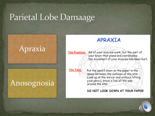 Apraxia
Anosognosia
 