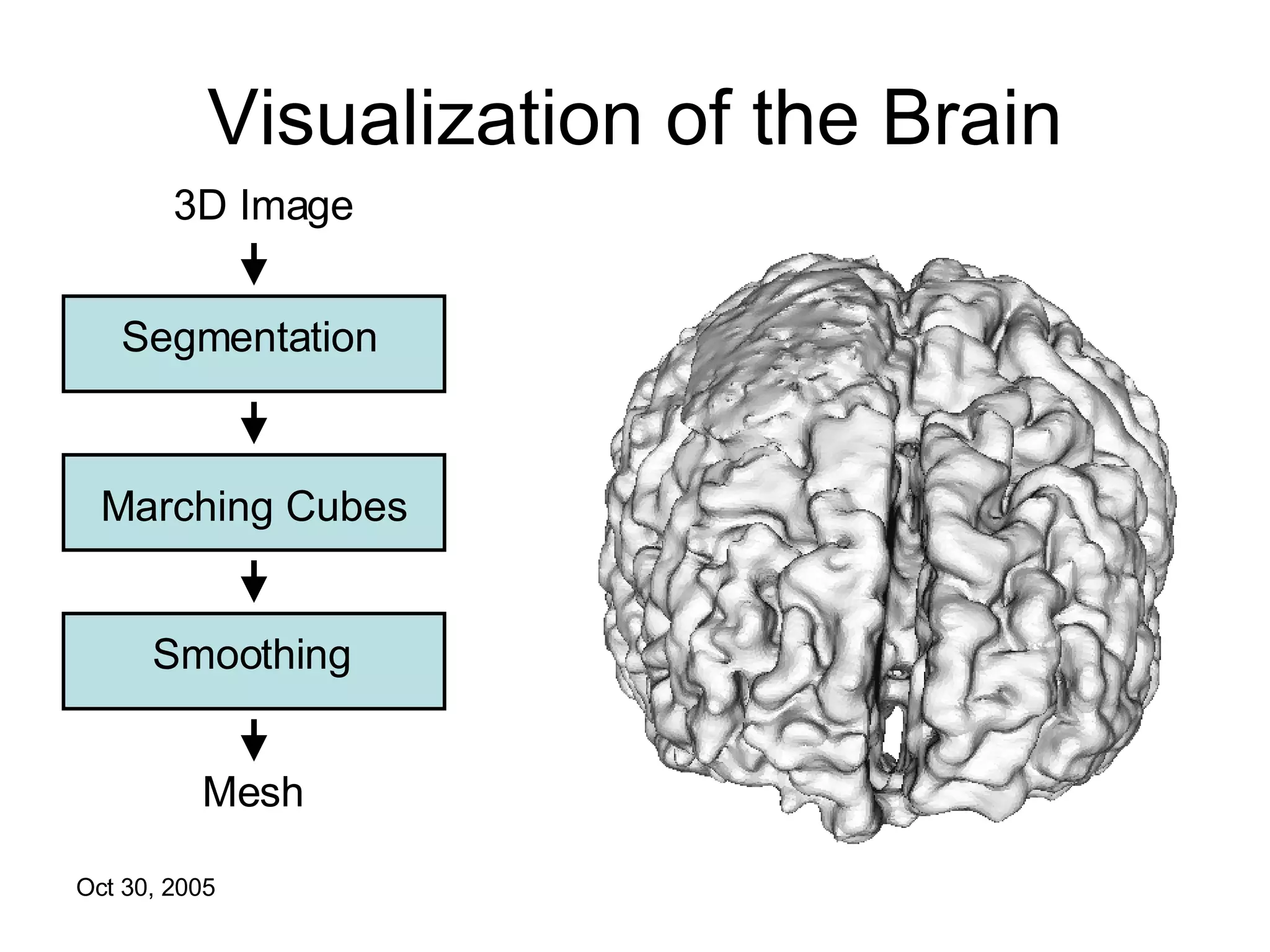 Visualization of the Brain 3D Image Segmentation Marching Cubes Smoothing Mesh 