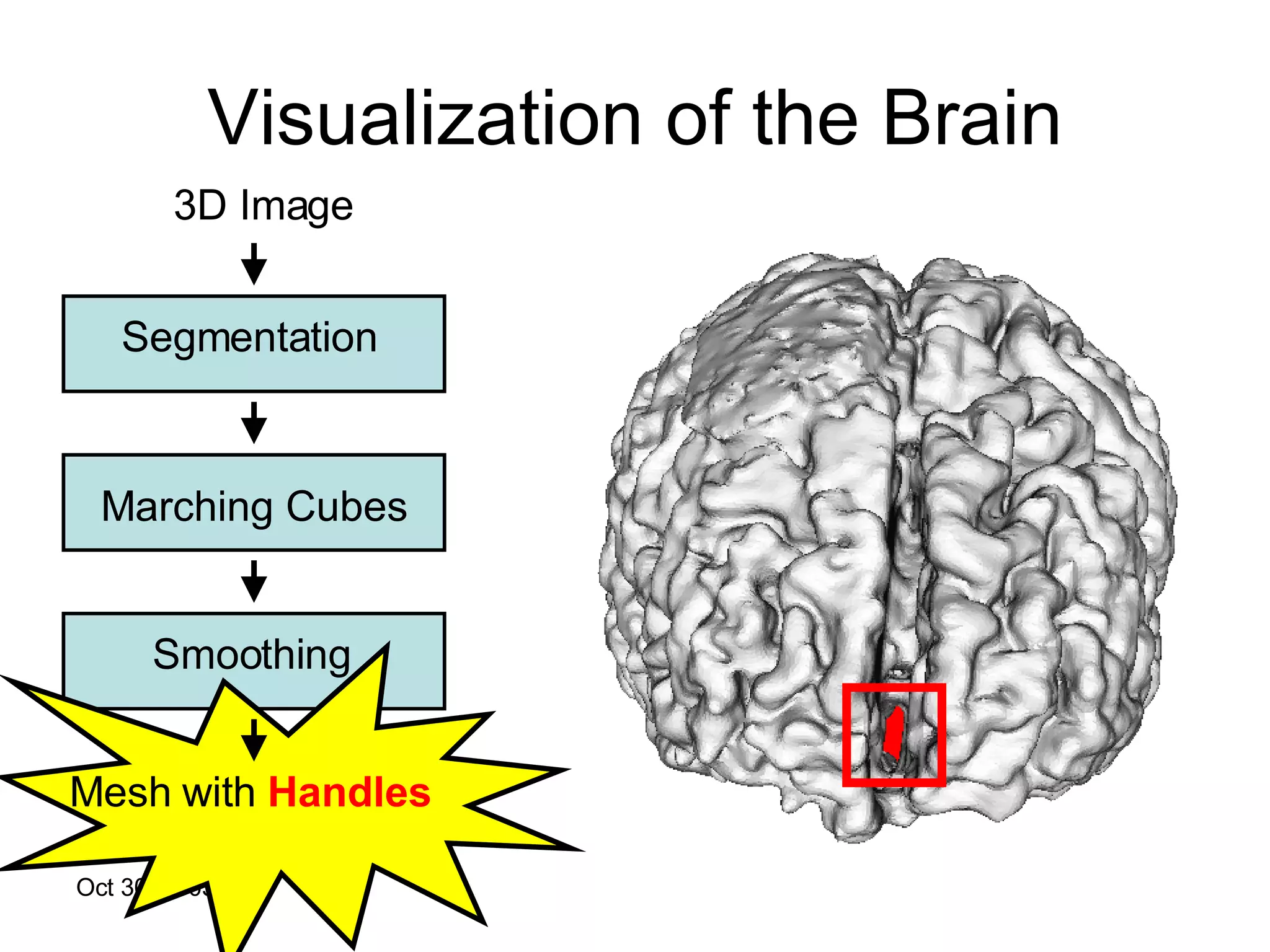 Visualization of the Brain 3D Image Segmentation Marching Cubes Smoothing Mesh with  Handles 