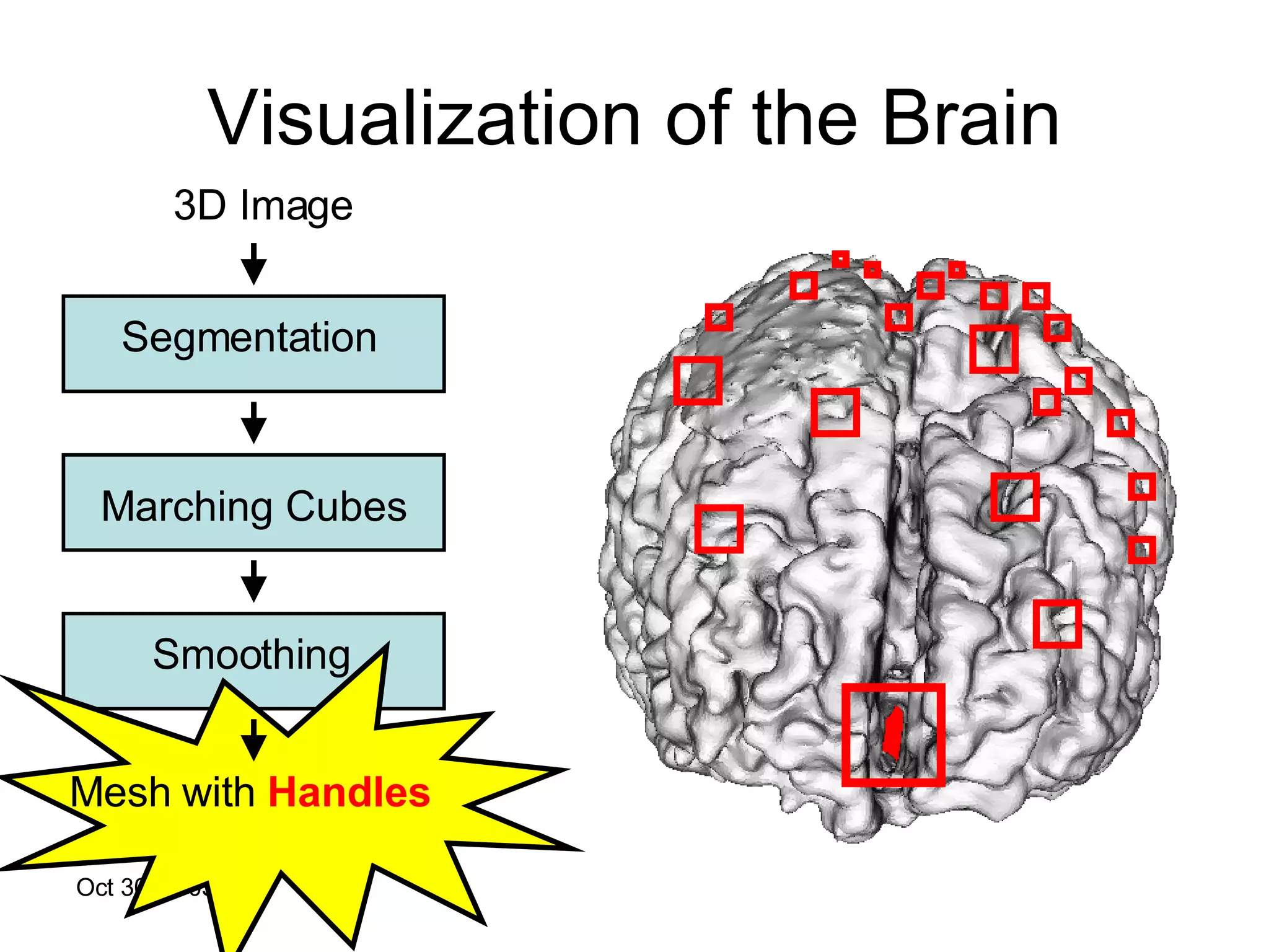 Visualization of the Brain 3D Image Segmentation Marching Cubes Smoothing Mesh with  Handles 