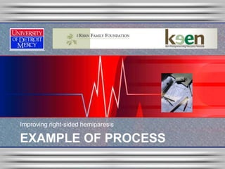 Improving right-sided hemiparesis

EXAMPLE OF PROCESS
 