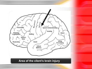Area of the client’s brain injury
 