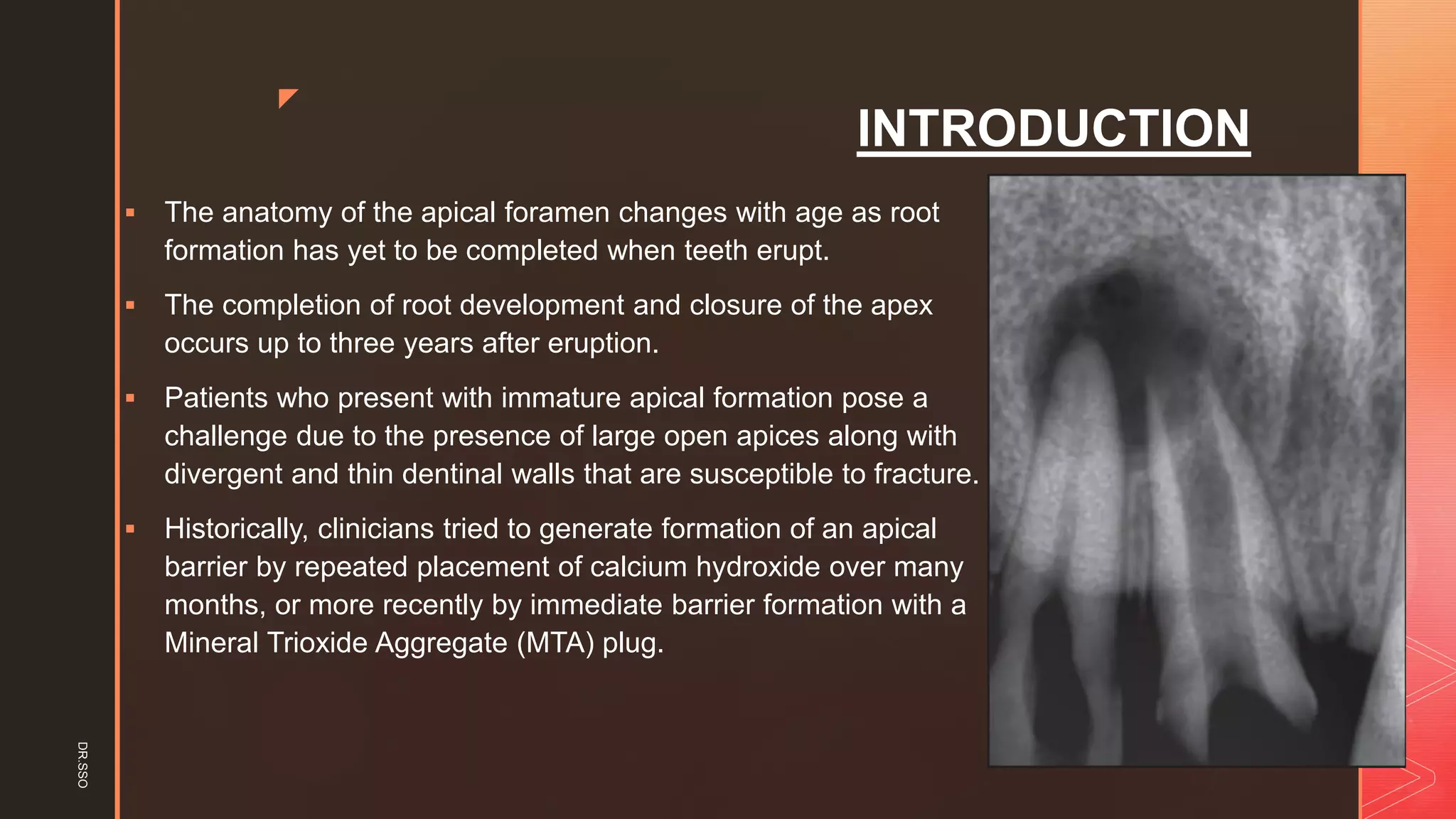 z
INTRODUCTION
▪ The anatomy of the apical foramen changes with age as root
formation has yet to be completed when teeth erupt.
▪ The completion of root development and closure of the apex
occurs up to three years after eruption.
▪ Patients who present with immature apical formation pose a
challenge due to the presence of large open apices along with
divergent and thin dentinal walls that are susceptible to fracture.
▪ Historically, clinicians tried to generate formation of an apical
barrier by repeated placement of calcium hydroxide over many
months, or more recently by immediate barrier formation with a
Mineral Trioxide Aggregate (MTA) plug.
DR.SSO
 