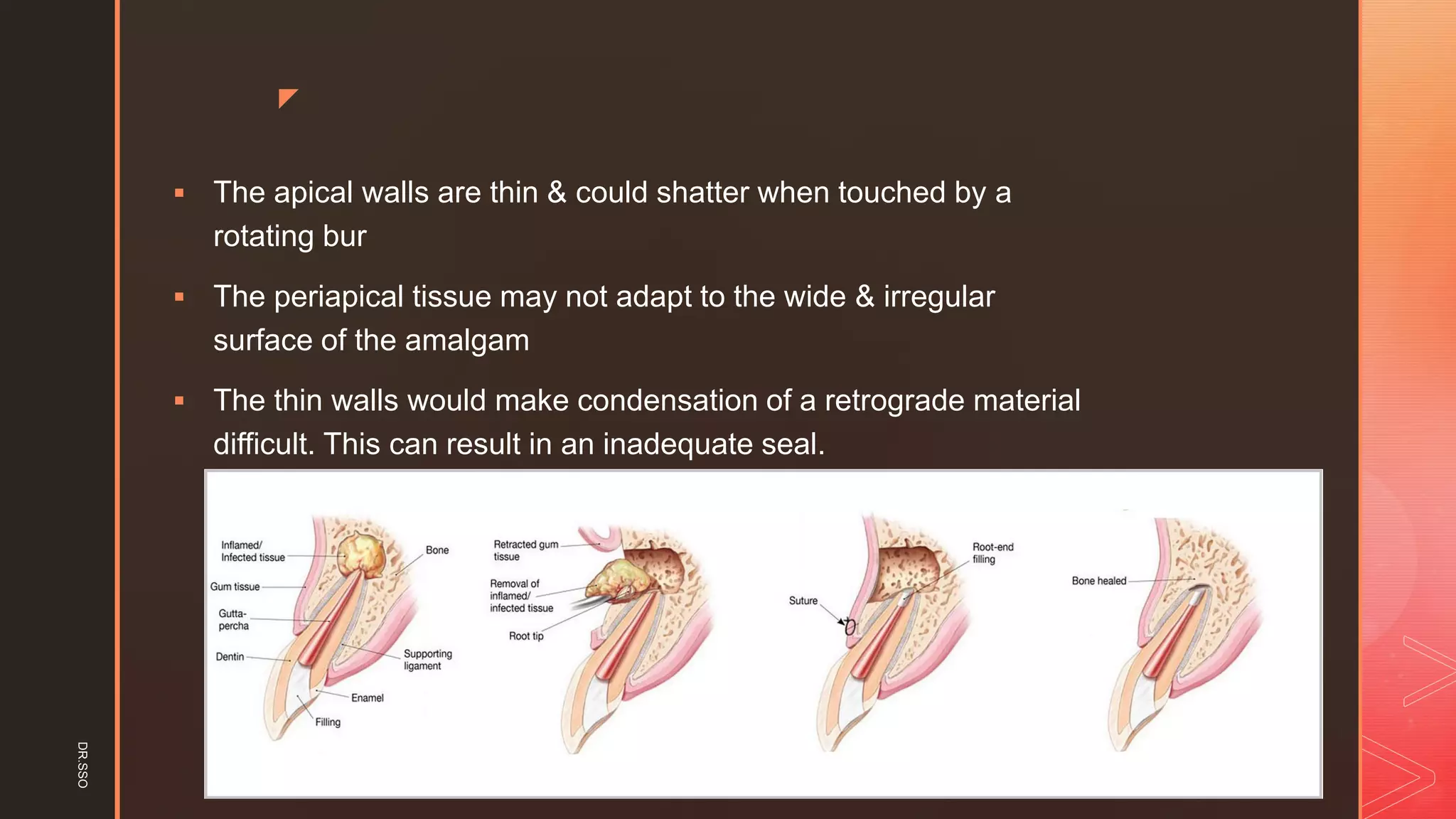 z
▪ The apical walls are thin & could shatter when touched by a
rotating bur
▪ The periapical tissue may not adapt to the wide & irregular
surface of the amalgam
▪ The thin walls would make condensation of a retrograde material
difficult. This can result in an inadequate seal.
DR.SSO
 