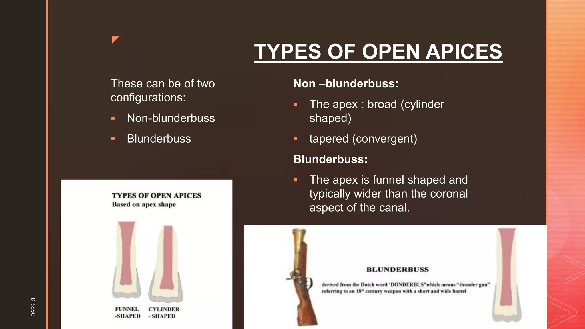 z
TYPES OF OPEN APICES
These can be of two
configurations:
▪ Non-blunderbuss
▪ Blunderbuss
Non –blunderbuss:
▪ The apex : broad (cylinder
shaped)
▪ tapered (convergent)
Blunderbuss:
▪ The apex is funnel shaped and
typically wider than the coronal
aspect of the canal.
DR.SSO
 