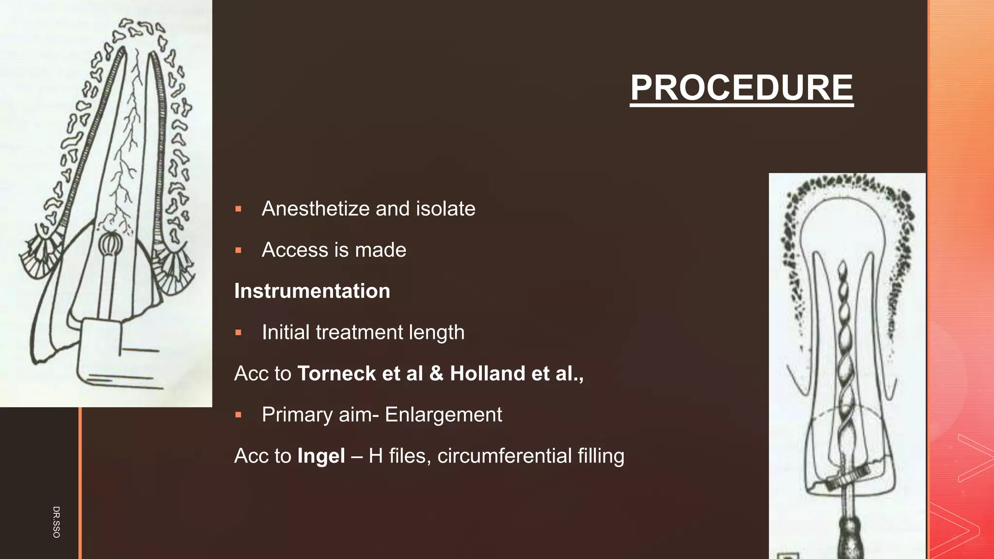 z
PROCEDURE
▪ Anesthetize and isolate
▪ Access is made
Instrumentation
▪ Initial treatment length
Acc to Torneck et al & Holland et al.,
▪ Primary aim- Enlargement
Acc to Ingel – H files, circumferential filling
DR.SSO
 
