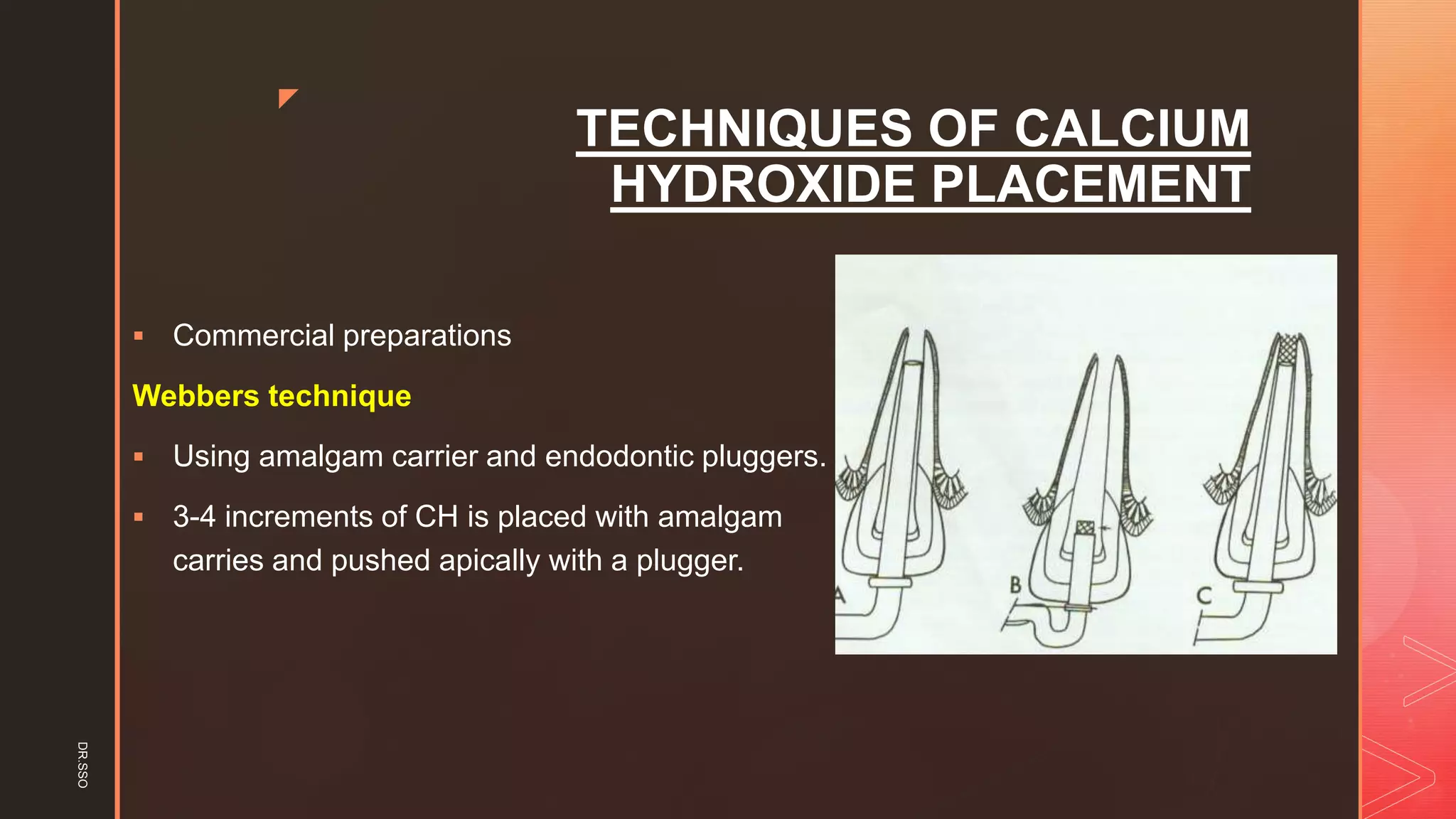 z
TECHNIQUES OF CALCIUM
HYDROXIDE PLACEMENT
▪ Commercial preparations
Webbers technique
▪ Using amalgam carrier and endodontic pluggers.
▪ 3-4 increments of CH is placed with amalgam
carries and pushed apically with a plugger.
DR.SSO
 