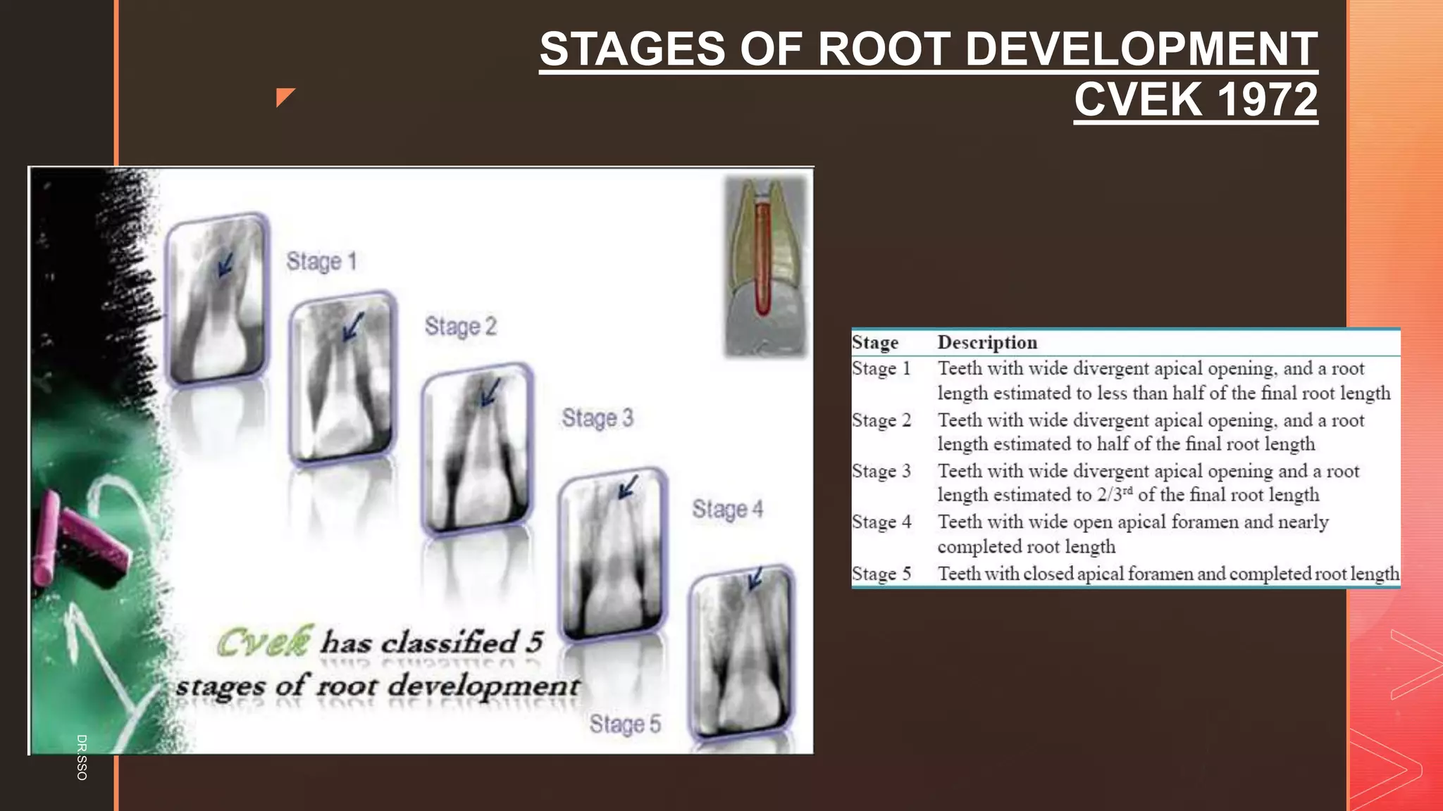 z
STAGES OF ROOT DEVELOPMENT
CVEK 1972
DR.SSO
 