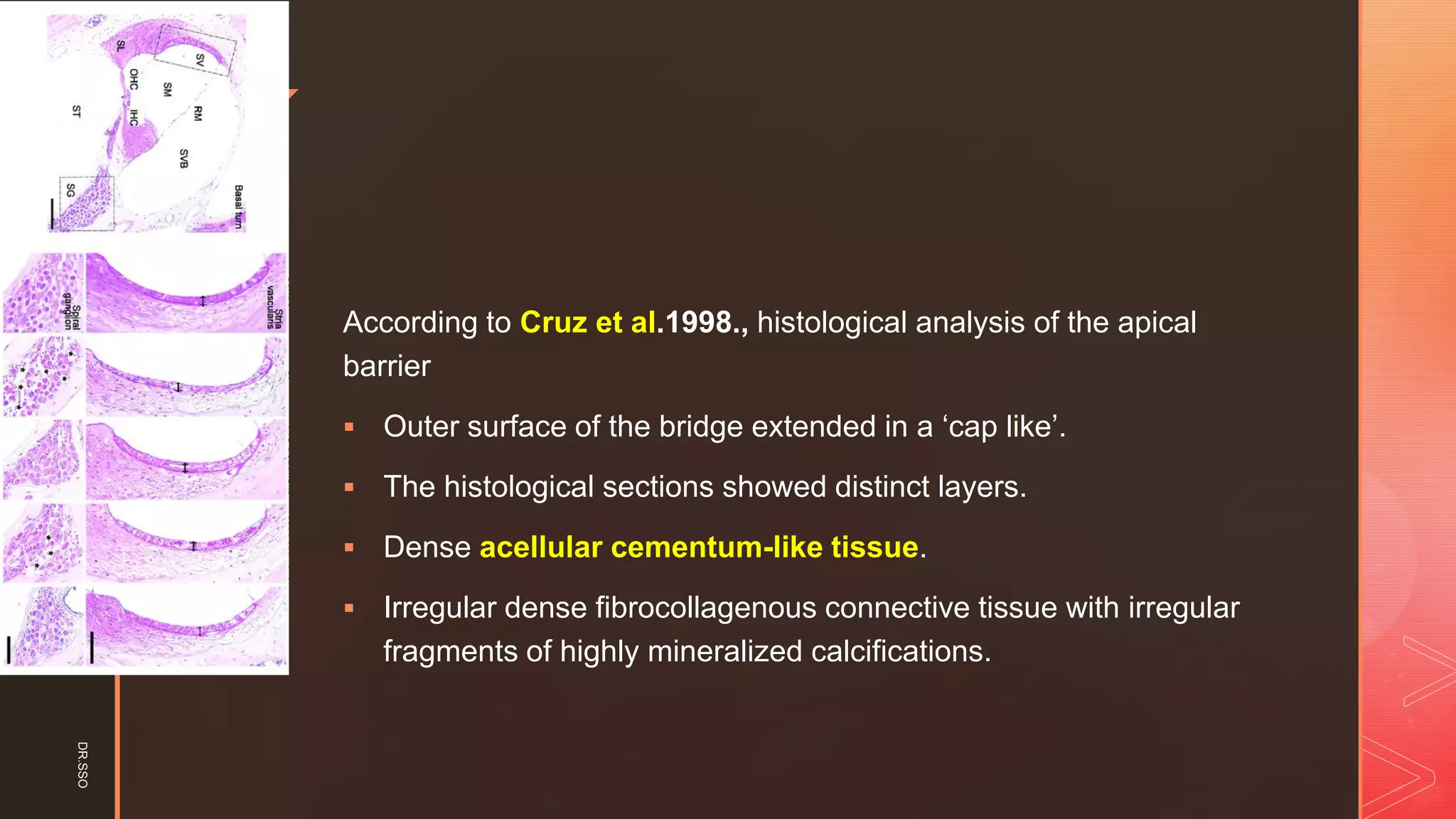 z
According to Cruz et al.1998., histological analysis of the apical
barrier
▪ Outer surface of the bridge extended in a ‘cap like’.
▪ The histological sections showed distinct layers.
▪ Dense acellular cementum-like tissue.
▪ Irregular dense fibrocollagenous connective tissue with irregular
fragments of highly mineralized calcifications.
DR.SSO
 
