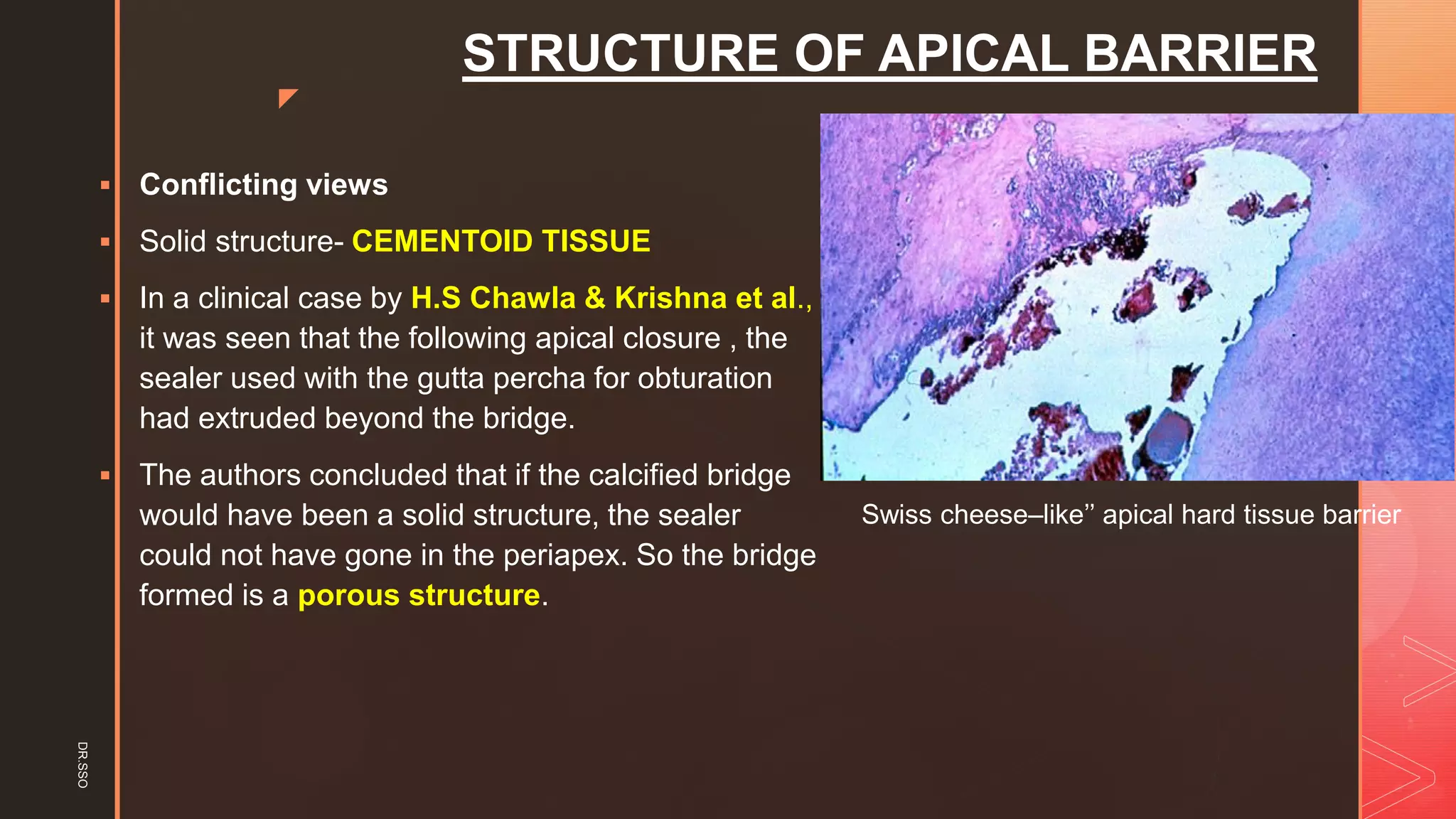 z
STRUCTURE OF APICAL BARRIER
▪ Conflicting views
▪ Solid structure- CEMENTOID TISSUE
▪ In a clinical case by H.S Chawla & Krishna et al.,
it was seen that the following apical closure , the
sealer used with the gutta percha for obturation
had extruded beyond the bridge.
▪ The authors concluded that if the calcified bridge
would have been a solid structure, the sealer
could not have gone in the periapex. So the bridge
formed is a porous structure.
Swiss cheese–like’’ apical hard tissue barrier
DR.SSO
 