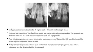 • Collagen-calcium was make altered at 20 mg/ml in a 0.1-M acetatebuffer at a pH of 3.5.
• A coronal seal consistingof Dycal and IRM cement was placed and a radiograph was taken. The symptoms had
decreased at the end of a week and at two weeks the tooth was asymptomatic.
• Acid-etched composites were placed to restore the anatomicalcrown of the maxillary left lateral incisor and the
incisal edge fracturesof the central incisors.
• Postoperative radiograph was taken at seven weeks which showed continued apexogenesisand a diffuse
radiopaque area that developed within the root canal
 