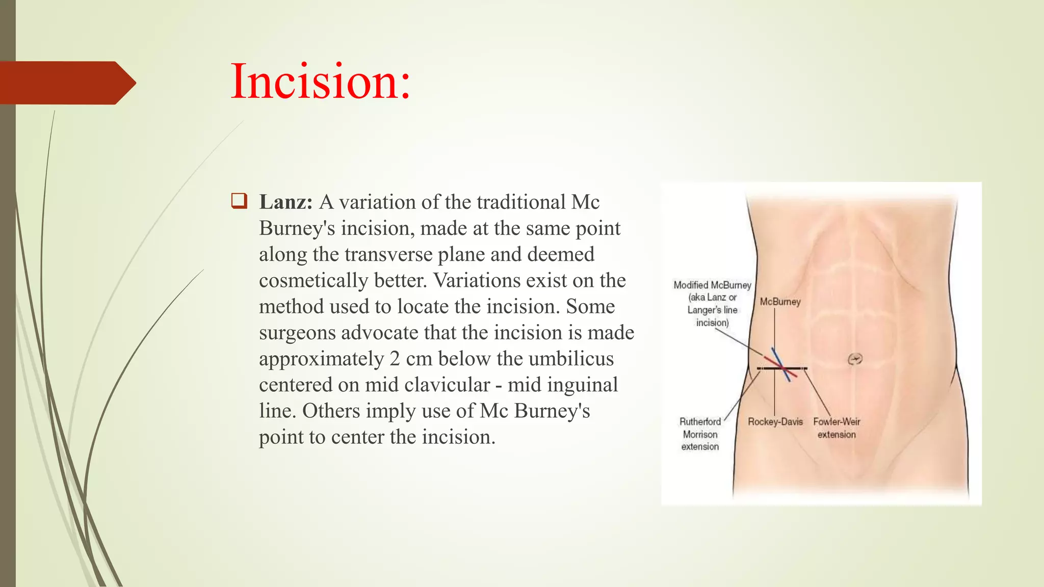 Open appendectomy | PPTX