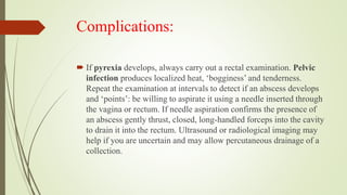 Open appendectomy | PPTX