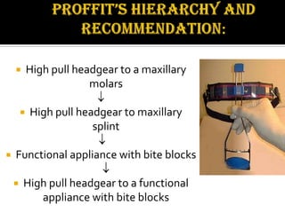 High pull headgear to a maxillary
molars







High pull headgear to maxillary
splint

Functional appliance with bite blocks


High pull headgear to a functional
appliance with bite blocks

 