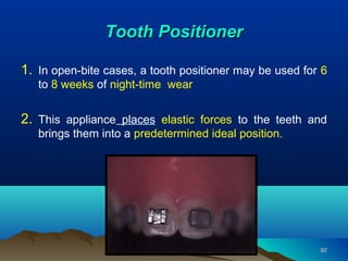 Bio mechanical considerations of Open bite. Dr. Ajay | PPT