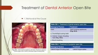 Treatment of Dental Anterior Open Bite
 1. Removal of the Cause
 