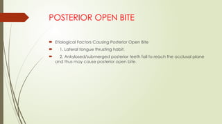  Etiological Factors Causing Posterior Open Bite
 1. Lateral tongue thrusting habit.
 2. Ankylosed/submerged posterior teeth fail to reach the occlusal plane
and thus may cause posterior open bite.
POSTERIOR OPEN BITE
 