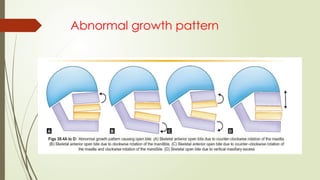 Abnormal growth pattern
 
