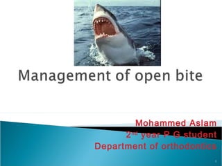 Mohammed Aslam
2nd
year P G student
Department of orthodontics
1
 