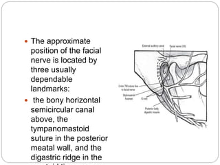  The approximate
position of the facial
nerve is located by
three usually
dependable
landmarks:
 the bony horizontal
semicircular canal
above, the
tympanomastoid
suture in the posterior
meatal wall, and the
digastric ridge in the
 