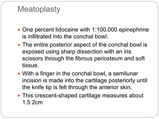 Meatoplasty
 One percent lidocaine with 1:100,000 epinephrine
is infiltrated into the conchal bowl.
 The entire posterior aspect of the conchal bowl is
exposed using sharp dissection with an iris
scissors through the fibrous periosteum and soft
tissue.
 With a finger in the conchal bowl, a semilunar
incision is made into the cartilage posteriorly until
the knife tip is felt through the anterior skin.
 This crescent-shaped cartilage measures about
1.5 2cm
 
