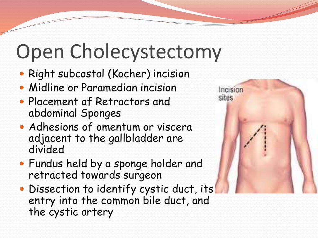 Open Vs Laparoscopic cholecystectomy