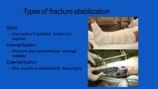 Typesof fracture stabilization
Splint
– Good option if operative fixation not
required
Internal fixation
– Wound is clean and softtissue coverage
available
External fixation
– Dirty wounds or extensivesoft tissue injury
 