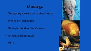 Dressings
• Temporary closures – rubber bands
• Wet to dry dressings
• Semi-permeable membranes
• Antibiotic bead pouch
• VAC
 
