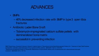 ADVANCES
• BMPs
– 40%decreased infection rate with BMPin type3 open tibia
fractures
• Antibiotic LadenBoneGraft
– Tobramycin-impregnated calcium sulfate pellets with
demineralized bonematrix
– successful in preventinginfection
*BESTTStudyGroup, Govender S,CsimmaC,Genant H, Valentin-OpranA. “Recombinant HumanBoneMorphogenetic Protein-2 for Treatment of OpenTibial Fractures:
Aprospective, controlled, randomized study of four hundred andfifty patients.” JBJS-A2002. 84(12): 2123-2134.
**Beardmore AA,BrooksDE,WenkeJC,ThomasDB.“Effectiveness of local antibiotic delivery with an osteoinductive and osteoconductive bone-graft
substitute.” JBJS-A2005. 87(1): 107-112.
 