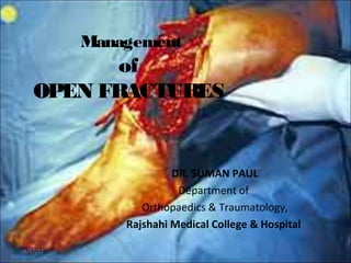 Management
of
OPEN FRACTURES
DR. SUMAN PAUL
Department of
Orthopaedics & Traumatology,
Rajshahi Medical College & Hospital
06/17/17
 