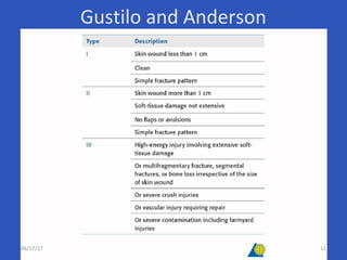 Gustilo and Anderson
06/17/17 11
 