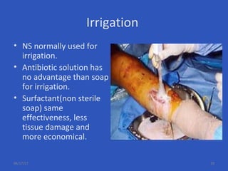 Irrigation
• NS normally used for
irrigation.
• Antibiotic solution has
no advantage than soap
for irrigation.
• Surfactant(non sterile
soap) same
effectiveness, less
tissue damage and
more economical.
06/17/17 29
 