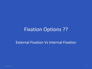 Fixation Options ??
External Fixation Vs Internal Fixation
06/17/17 45
 