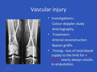 Vascular injury
• Investigations:-
Colour doppler study
Arteriography.
• Treatment:-
Arterial reconstruction
Bypass grafts.
• Timing:- loss of total blood
supply to the limb for > 8
hours nearly always results
in amputation.
06/17/17 74
 