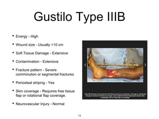 Gustilo Type IIIB
• Energy - High
• Wound size - Usually >10 cm
• Soft Tissue Damage - Extensive
• Contamination - Extensive
• Fracture pattern - Severe
comminution or segmental fractures
• Periosteal striping - Yes
• Skin coverage - Requires free tissue
flap or rotational flap coverage.
• Neurovascular Injury - Normal
13
 