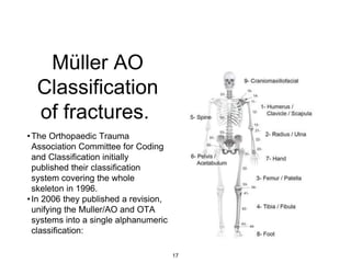 Müller AO
Classification
of fractures.
•The Orthopaedic Trauma
Association Committee for Coding
and Classification initially
published their classification
system covering the whole
skeleton in 1996.
•In 2006 they published a revision,
unifying the Muller/AO and OTA
systems into a single alphanumeric
classification:
17
 