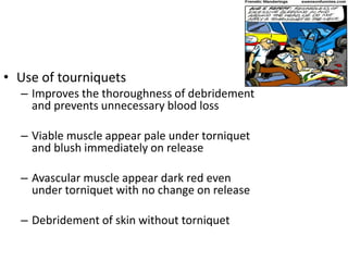 • Use of tourniquets
– Improves the thoroughness of debridement
and prevents unnecessary blood loss
– Viable muscle appear pale under torniquet
and blush immediately on release
– Avascular muscle appear dark red even
under torniquet with no change on release
– Debridement of skin without torniquet
 