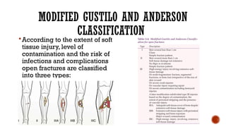 Comprehensive Management and Classification of Open Fractures in Trauma ...