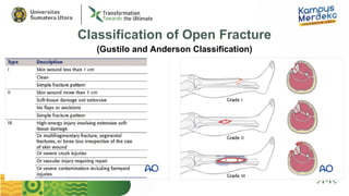 Anderson Classification OPEN FRACTURE MANAGEMENT -dikompresi.pptx