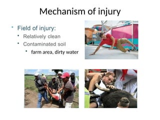 Open Fracture management 2-.........1.pptx