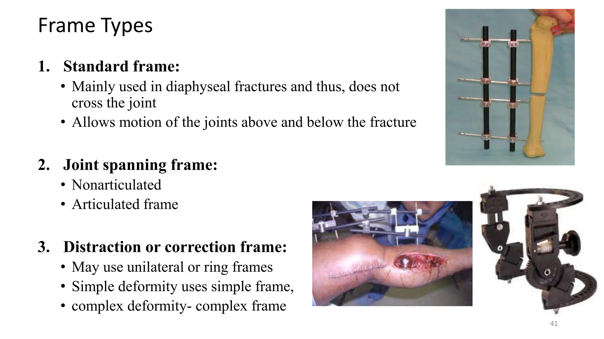 OPEN FRACTURE MANAGEMENT AND PRINCIPLE OF EXTERNAL FIXATION.pptx