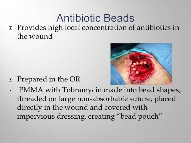 Managment of Open fractures