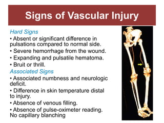 Signs of Vascular Injury
Hard Signs
• Absent or significant difference in
pulsations compared to normal side.
• Severe hemorrhage from the wound.
• Expanding and pulsatile hematoma.
• Bruit or thrill.
Associated Signs
• Associated numbness and neurologic
deficit.
• Difference in skin temperature distal
to injury.
• Absence of venous filling.
• Absence of pulse-oximeter reading.
No capillary blanching
 