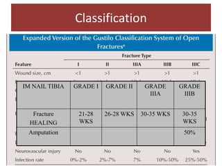 IM NAIL TIBIA GRADE I GRADE II GRADE
IIIA
GRADE
IIIB
Fracture
HEALING
21-28
WKS
26-28 WKS 30-35 WKS 30-35
WKS
Amputation 50%
Classification
 