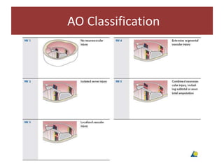 AO Classification
 