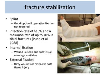 fracture stabilization
• Splint
– Good option if operative fixation
not required
• infection rate of >15% and a
malunion rate of up to 70% in
tibial fractures (Puno et al
1988)
• Internal fixation
– Wound is clean and soft tissue
coverage available
• External fixation
– Dirty wounds or extensive soft
tissue injury
 