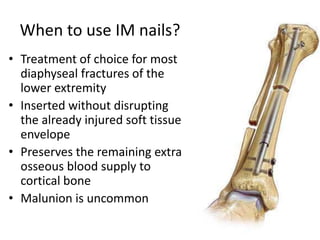 When to use IM nails?
• Treatment of choice for most
diaphyseal fractures of the
lower extremity
• Inserted without disrupting
the already injured soft tissue
envelope
• Preserves the remaining extra
osseous blood supply to
cortical bone
• Malunion is uncommon
 