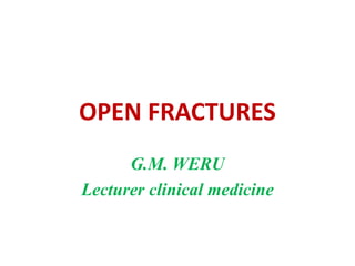 OPEN FRACTURES
G.M. WERU
Lecturer clinical medicine
 