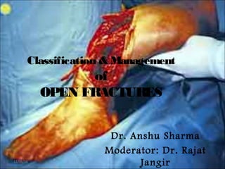 Classification & Management
of
OPEN FRACTURES
Dr. Anshu Sharma
Moderator: Dr. Rajat
Jangir11/06/16
 