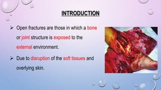 INTRODUCTION
 Open fractures are those in which a bone
or joint structure is exposed to the
external environment.
 Due to disruption of the soft tissues and
overlying skin.
 